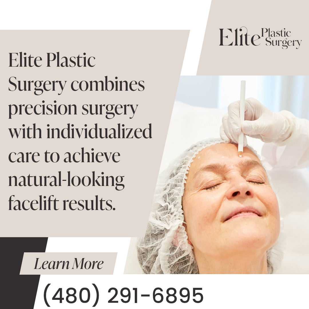 Why a Face Lift Works